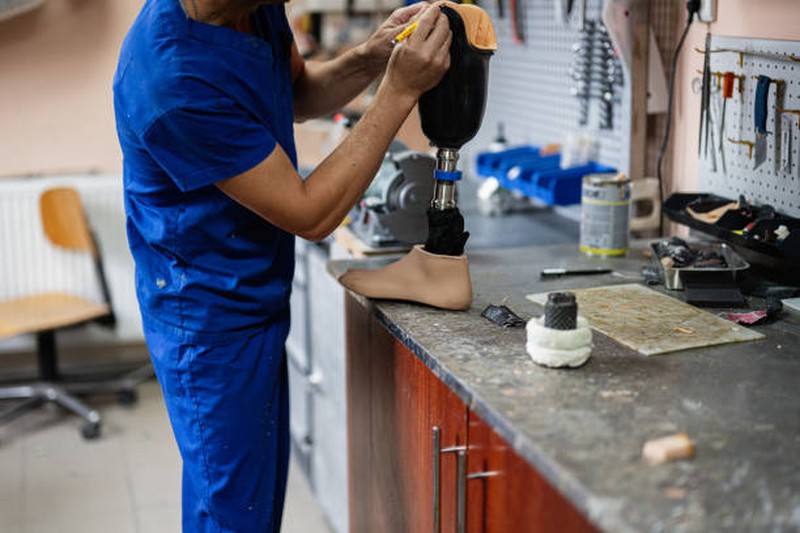 Maintain and Care for Carbon Fiber Prosthetic Limbs Maintain and Care for Carbon Fiber Prosthetic Limbs